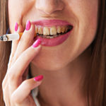 What Does Smoking Do to Your Teeth